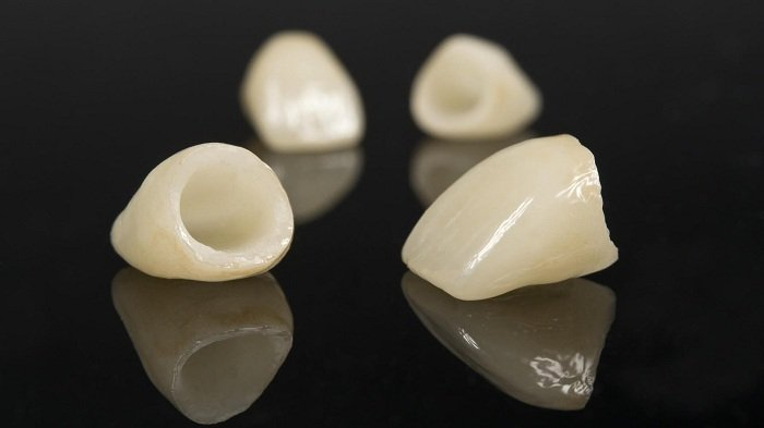 Tìm hiểu về các loại răng sứ Zirconia đang có mặt trên thị trường